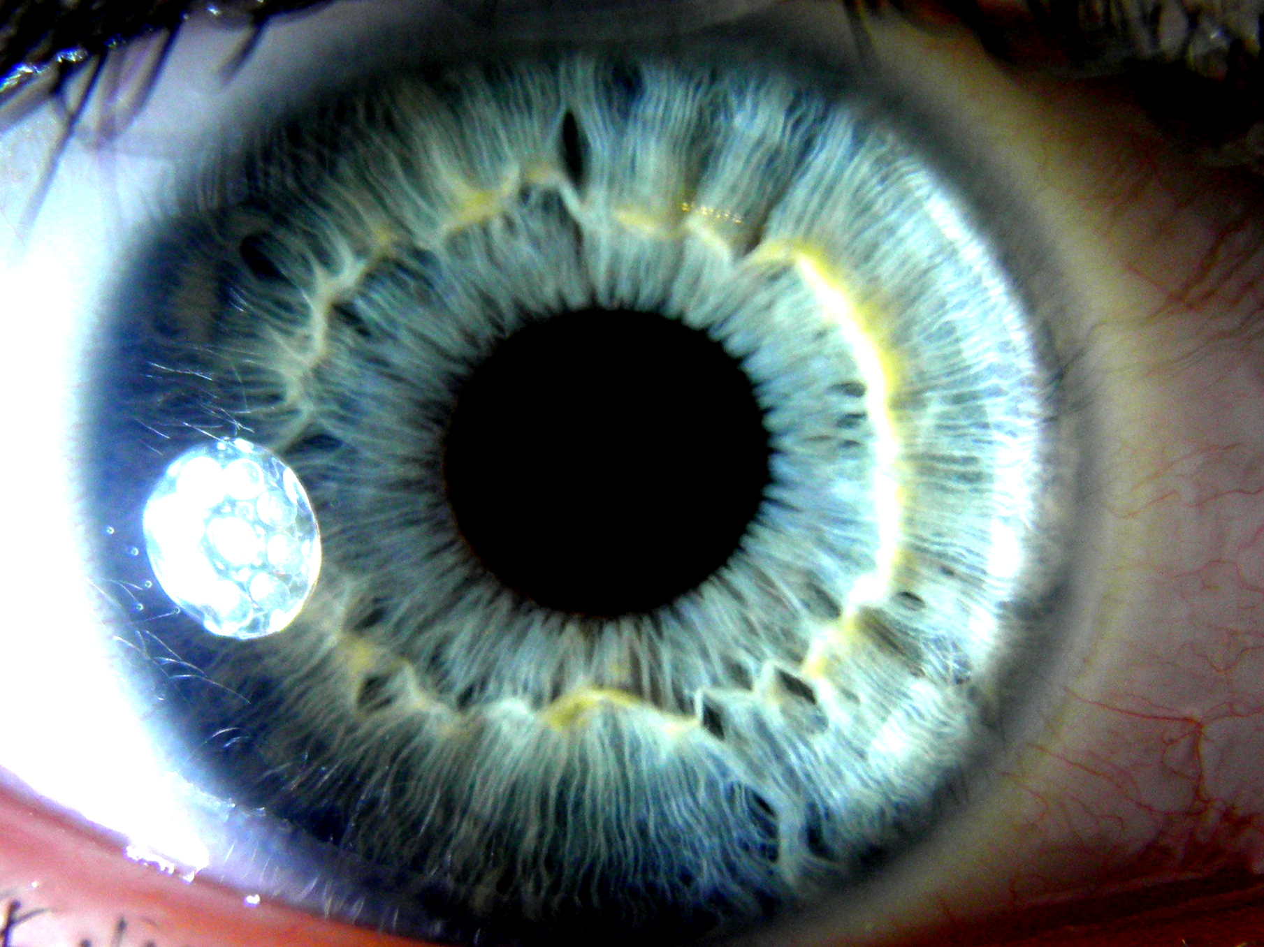 Iridologie oko psychosomatika diagnostika z očí